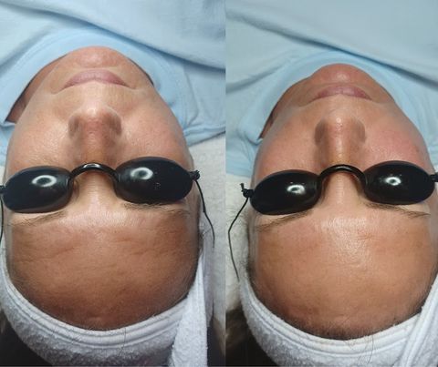 The KY Skin Specialist, spa in Murray, KY